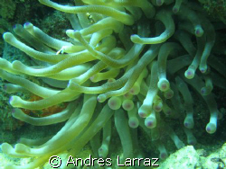 CLUB TIPPED ANEMONE by Andres Larraz 
